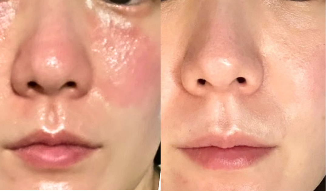 Wさんから届いたご使用記録写真